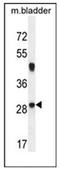Neurocalcin Delta antibody, AP52821PU-N, Origene, Western Blot image 
