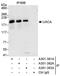 Uveal Autoantigen With Coiled-Coil Domains And Ankyrin Repeats antibody, A301-382A, Bethyl Labs, Immunoprecipitation image 