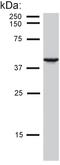 Keratin-19 antibody, SM1822PS, Origene, Western Blot image 