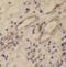 Stomatin-like protein 2 antibody, FNab08346, FineTest, Immunohistochemistry paraffin image 