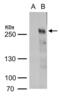Methylcytosine dioxygenase TET2 antibody, PA5-35847, Invitrogen Antibodies, Western Blot image 