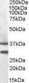 Melanocortin receptor 5 antibody, GTX88470, GeneTex, Western Blot image 