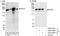 FGR Proto-Oncogene, Src Family Tyrosine Kinase antibody, A300-346A, Bethyl Labs, Immunoprecipitation image 