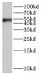 SAMM50 Sorting And Assembly Machinery Component antibody, FNab07593, FineTest, Western Blot image 