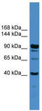 Intraflagellar Transport 88 antibody, TA335680, Origene, Western Blot image 