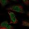 Arginyltransferase 1 antibody, PA5-58391, Invitrogen Antibodies, Immunofluorescence image 