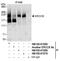 ERCC Excision Repair 6, Chromatin Remodeling Factor antibody, NB100-61070, Novus Biologicals, Immunoprecipitation image 
