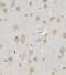 Autophagy Related 13 antibody, FNab00668, FineTest, Immunohistochemistry paraffin image 