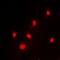 Protein SZT2 antibody, orb78209, Biorbyt, Immunofluorescence image 