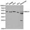 Vascular Endothelial Growth Factor D antibody, orb186487, Biorbyt, Western Blot image 