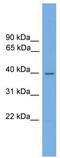 NmrA-like family domain-containing protein 1 antibody, TA329936, Origene, Western Blot image 