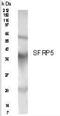 Secreted Frizzled Related Protein 5 antibody, PA1-16643, Invitrogen Antibodies, Western Blot image 