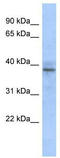Zinc Finger Protein 625 antibody, TA345520, Origene, Western Blot image 