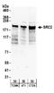 FGR Proto-Oncogene, Src Family Tyrosine Kinase antibody, A300-345A, Bethyl Labs, Western Blot image 