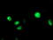 Cytochrome P450 Family 2 Subfamily C Member 9 antibody, M00465, Boster Biological Technology, Immunofluorescence image 