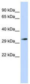 Four And A Half LIM Domains 1 antibody, TA329448, Origene, Western Blot image 