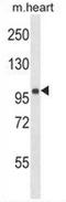 Formin Homology 2 Domain Containing 1 antibody, AP51668PU-N, Origene, Western Blot image 