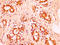 H12 antibody, LS-C670354, Lifespan Biosciences, Immunohistochemistry paraffin image 