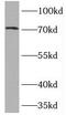 DNA topoisomerase I, mitochondrial antibody, FNab08866, FineTest, Western Blot image 