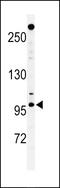 Nucleoporin 210 antibody, 64-209, ProSci, Western Blot image 