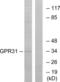 Probable G-protein coupled receptor 31 antibody, abx015325, Abbexa, Western Blot image 