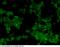 ERBB2 antibody, 10004-MM03, Sino Biological, Immunohistochemistry frozen image 