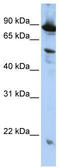 Zinc finger CCCH-type with G patch domain-containing protein antibody, TA329496, Origene, Western Blot image 