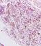 Sphingosine Kinase 1 antibody, orb7002, Biorbyt, Immunohistochemistry paraffin image 