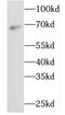 Glyceraldehyde-3-phosphate dehydrogenase, testis-specific antibody, FNab03345, FineTest, Western Blot image 