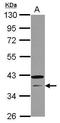 Cyclin N-Terminal Domain Containing 1 antibody, GTX121398, GeneTex, Western Blot image 