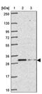 Proteasome Subunit Beta 11 antibody, NBP2-34158, Novus Biologicals, Western Blot image 