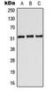 Cyclic AMP-dependent transcription factor ATF-7 antibody, LS-C354157, Lifespan Biosciences, Western Blot image 