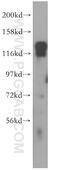 Serine/threonine-protein phosphatase 6 regulatory subunit 3 antibody, 16944-1-AP, Proteintech Group, Western Blot image 