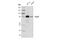 Zinc Finger And BTB Domain Containing 16 antibody, 39784S, Cell Signaling Technology, Western Blot image 