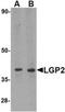 Lgp2 antibody, NBP1-76390, Novus Biologicals, Western Blot image 