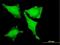 LIM domain only protein 3 antibody, H00055885-M06, Novus Biologicals, Immunofluorescence image 