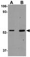 Coiled-Coil Domain Containing 47 antibody, GTX31976, GeneTex, Western Blot image 