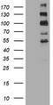 ALK Receptor Tyrosine Kinase antibody, CF801065, Origene, Western Blot image 