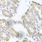 MHC Class I Polypeptide-Related Sequence A antibody, A1390, ABclonal Technology, Immunohistochemistry paraffin image 