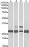Phosphoglycerate mutase 1 antibody, PA5-17935, Invitrogen Antibodies, Western Blot image 