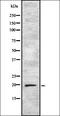Interferon Alpha 4 antibody, orb335325, Biorbyt, Western Blot image 