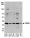 Proteasome activator complex subunit 3 antibody, A303-879A, Bethyl Labs, Western Blot image 