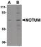 Notum, Palmitoleoyl-Protein Carboxylesterase antibody, PA5-20788, Invitrogen Antibodies, Western Blot image 