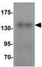 Zinc Finger MYM-Type Containing 3 antibody, GTX17097, GeneTex, Western Blot image 