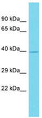 Homeobox protein Hox-A1 antibody, TA342265, Origene, Western Blot image 