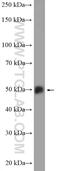 Protein Phosphatase 3 Catalytic Subunit Gamma antibody, 55163-1-AP, Proteintech Group, Western Blot image 