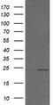 RAB21, Member RAS Oncogene Family antibody, TA505739, Origene, Western Blot image 