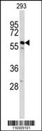 Cell Division Cycle 14B antibody, 63-773, ProSci, Western Blot image 