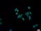 Centromere protein F antibody, 20982-1-AP, Proteintech Group, Immunofluorescence image 