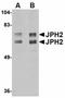 Junctophilin 2 antibody, orb75104, Biorbyt, Western Blot image 